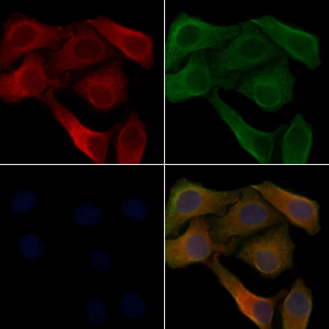 RGS7 Antibody in Immunocytochemistry (ICC/IF)