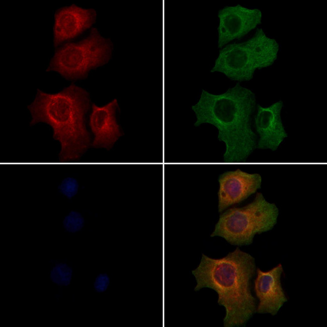 RPTN Antibody in Immunocytochemistry (ICC/IF)