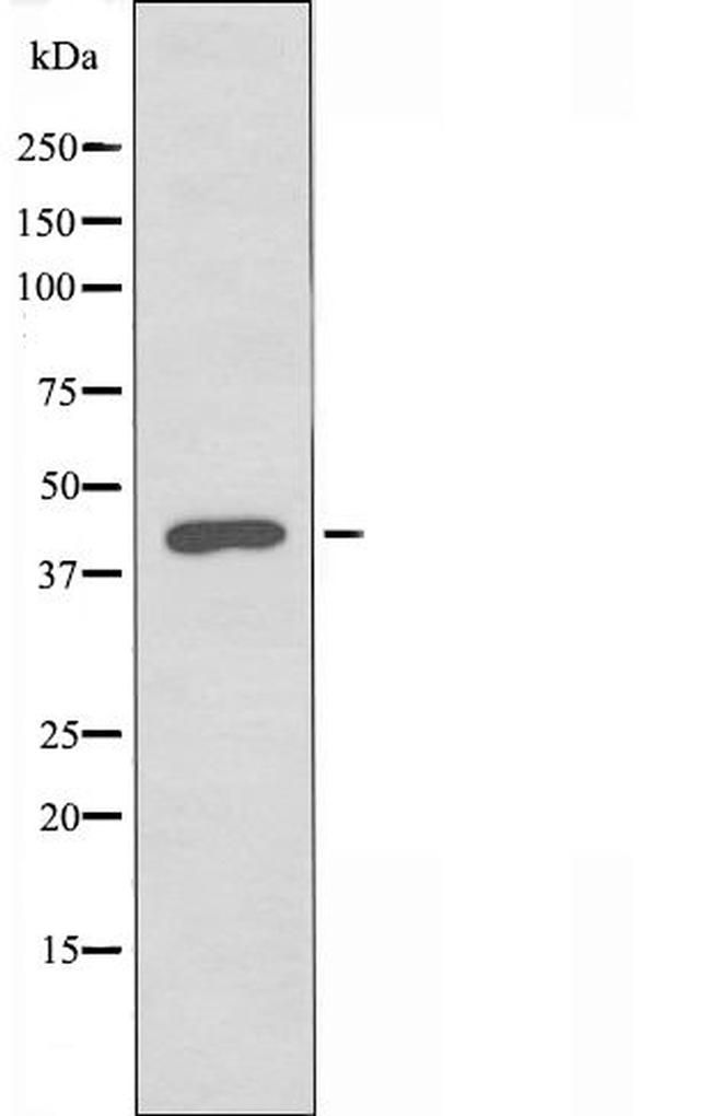 RFPL4A Antibody in Western Blot (WB)