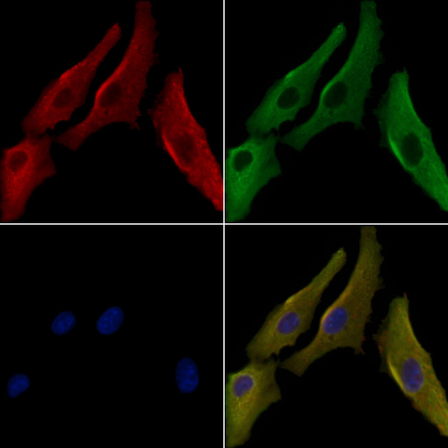 ARHGAP11A Antibody in Immunocytochemistry (ICC/IF)