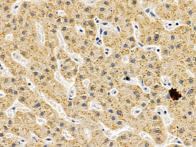 ARHGAP17 Antibody in Immunohistochemistry (Paraffin) (IHC (P))