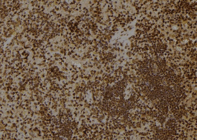 ARHGAP18 Antibody in Immunohistochemistry (Paraffin) (IHC (P))