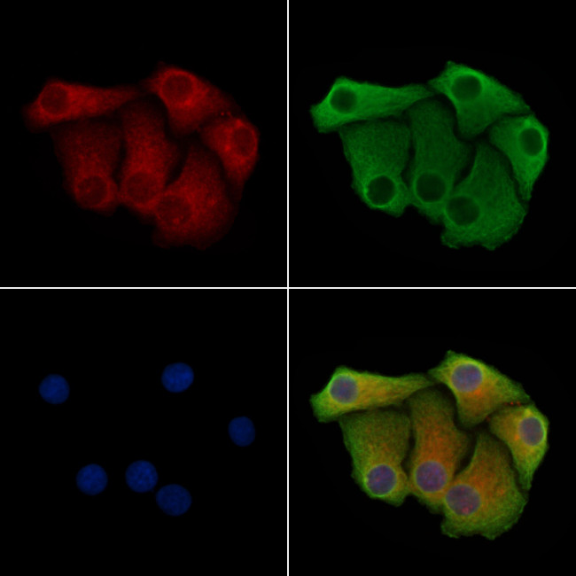 ARHGAP9 Antibody in Immunocytochemistry (ICC/IF)