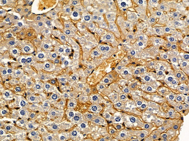 ARHGEF11 Antibody in Immunohistochemistry (Paraffin) (IHC (P))