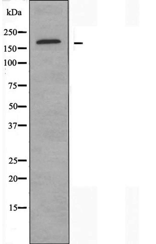 ARHGEF12 Antibody in Western Blot (WB)