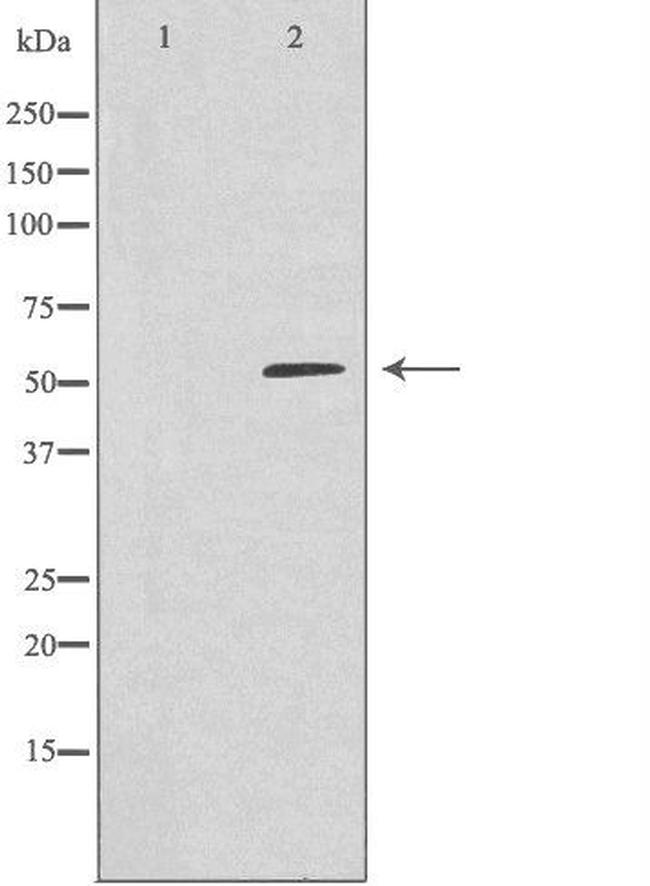 ARHGEF3 Antibody in Western Blot (WB)