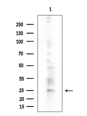 RhoD Antibody in Western Blot (WB)