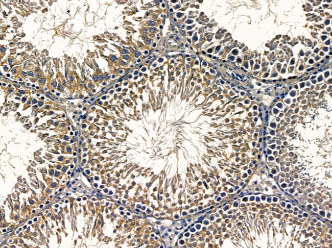 RIMKLA Antibody in Immunohistochemistry (Paraffin) (IHC (P))