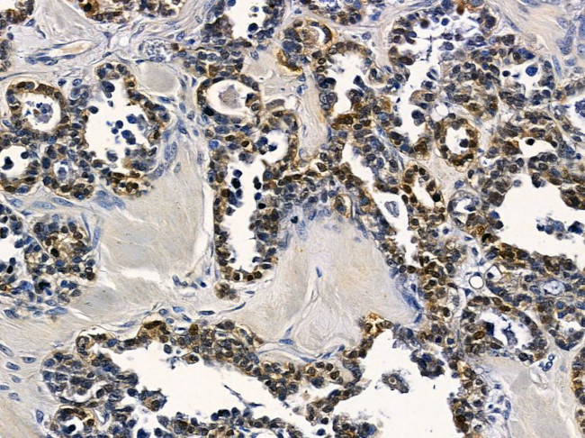 PLK5 Antibody in Immunohistochemistry (Paraffin) (IHC (P))