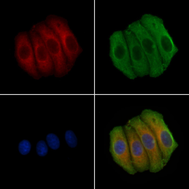TAOK1 Antibody in Immunocytochemistry (ICC/IF)