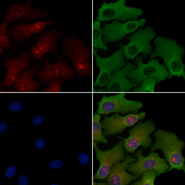 PPP2R3B Antibody in Immunocytochemistry (ICC/IF)