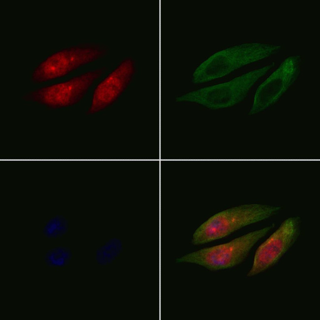PPP2R3C Antibody in Immunocytochemistry (ICC/IF)