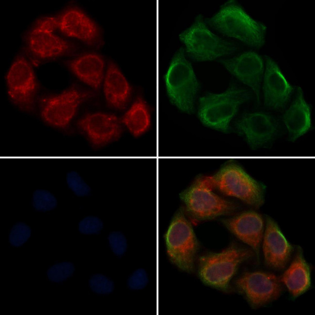 SHB Antibody in Immunocytochemistry (ICC/IF)