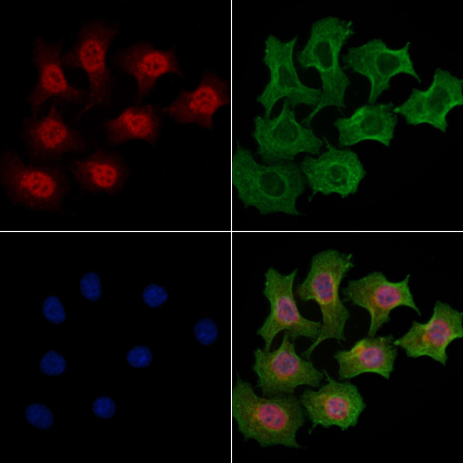 SH3TC1 Antibody in Immunocytochemistry (ICC/IF)