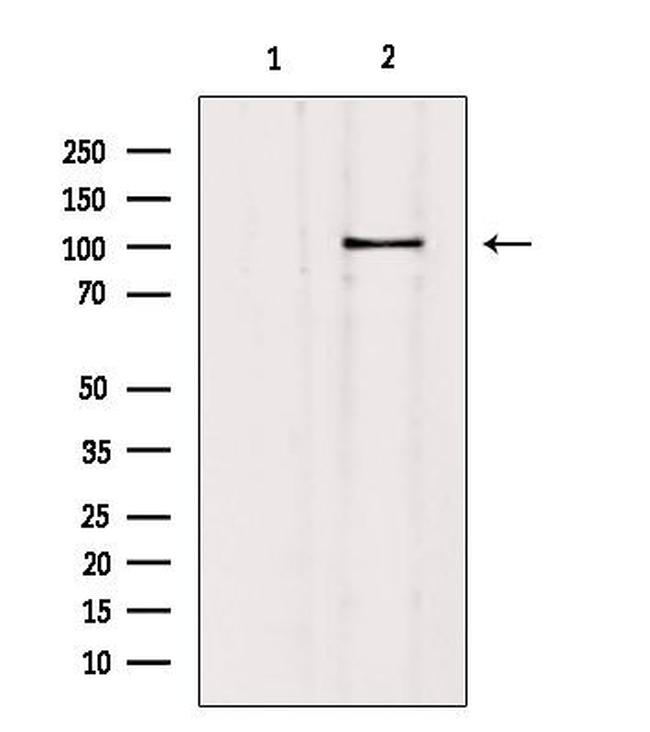 SLC4A11 Antibody in Western Blot (WB)