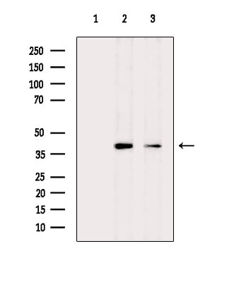 SLC8B1 Antibody in Western Blot (WB)