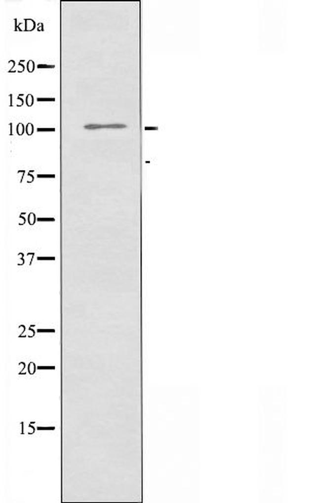 ATP1A2 Antibody in Western Blot (WB)