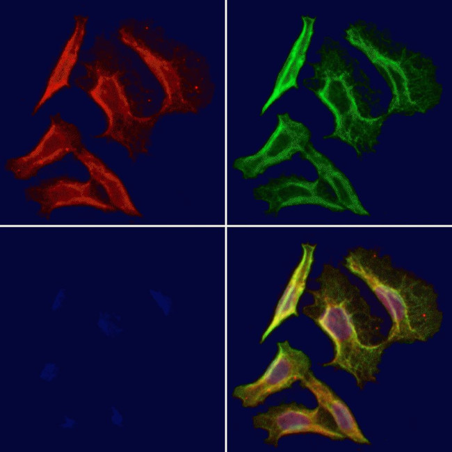 CD1E Antibody in Immunocytochemistry (ICC/IF)