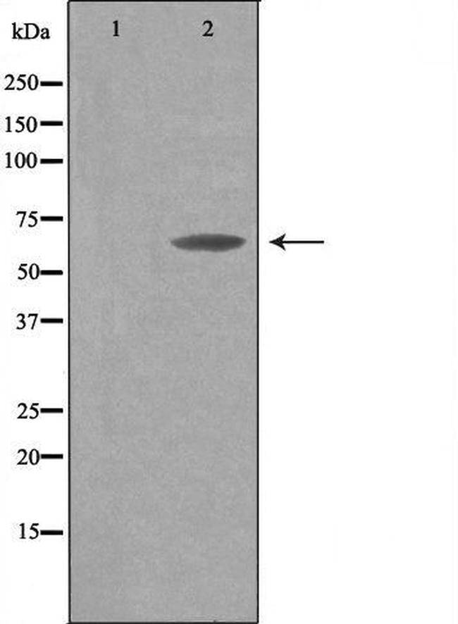THAP4 Antibody in Western Blot (WB)