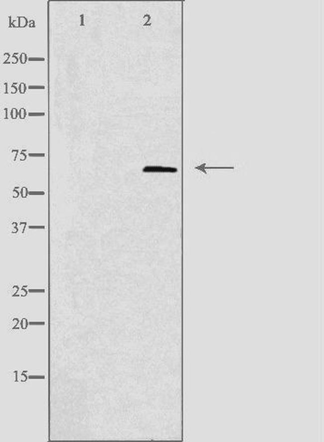TIGD1 Antibody in Western Blot (WB)