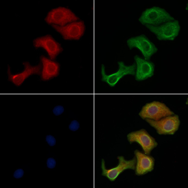 MTERF Antibody in Immunocytochemistry (ICC/IF)
