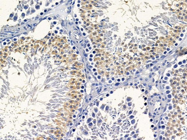 PEAK1 Antibody in Immunohistochemistry (Paraffin) (IHC (P))