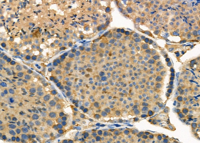 USP45 Antibody in Immunohistochemistry (Paraffin) (IHC (P))