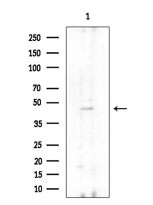 UEVLD Antibody in Western Blot (WB)