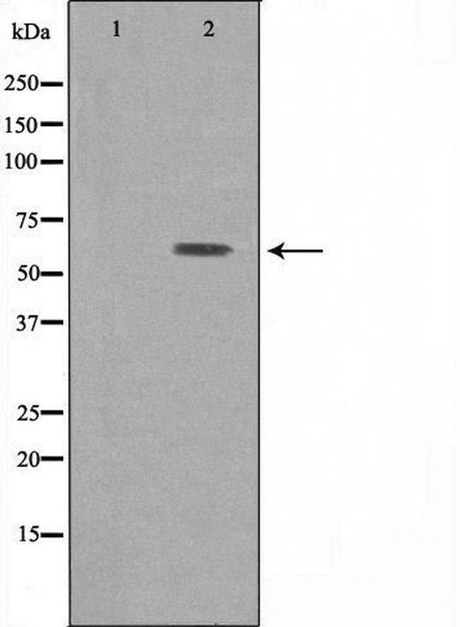 ATP6V1B1 Antibody in Western Blot (WB)