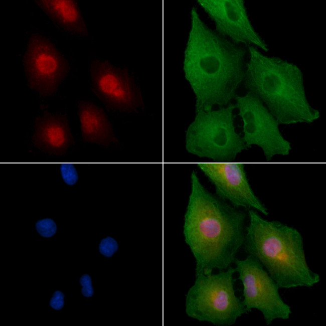 ZNF420 Antibody in Immunocytochemistry (ICC/IF)