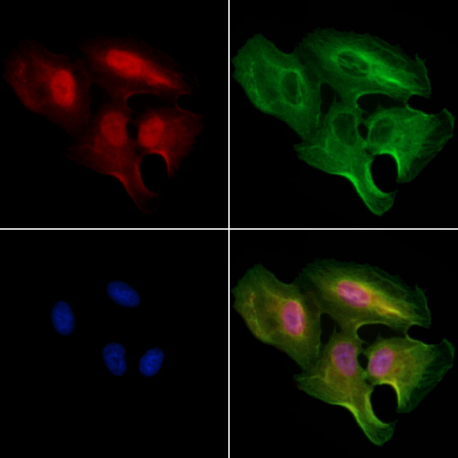 ZNF460 Antibody in Immunocytochemistry (ICC/IF)