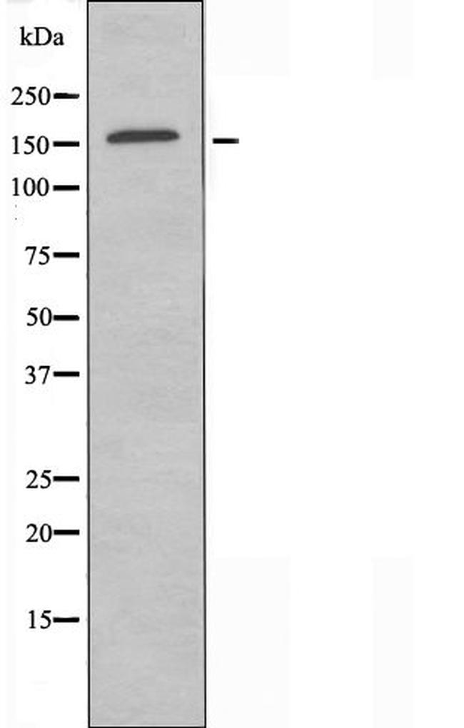ZNF592 Antibody in Western Blot (WB)