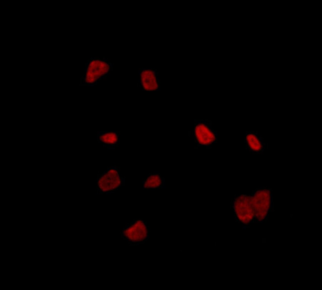 RALY Antibody in Immunocytochemistry (ICC/IF)