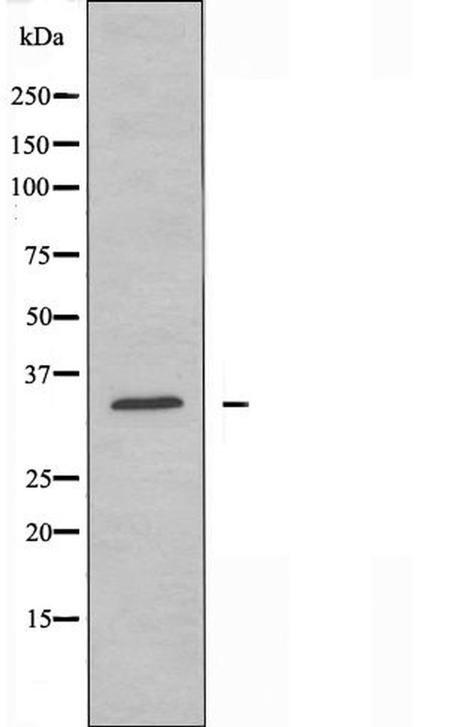 MED27 Antibody in Western Blot (WB)