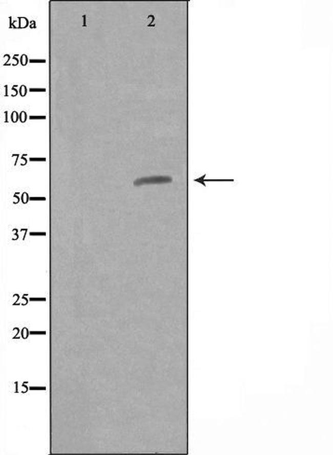 ZNF329 Antibody in Western Blot (WB)