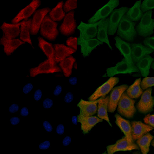 PPFIBP1 Antibody in Immunocytochemistry (ICC/IF)