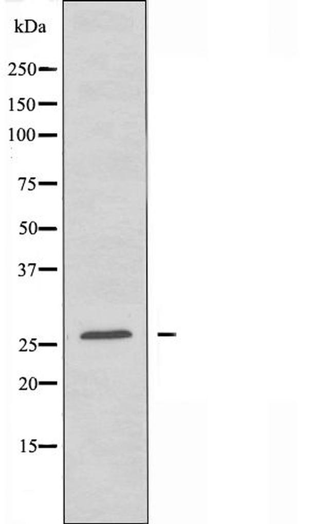 Nkx2.8 Antibody in Western Blot (WB)