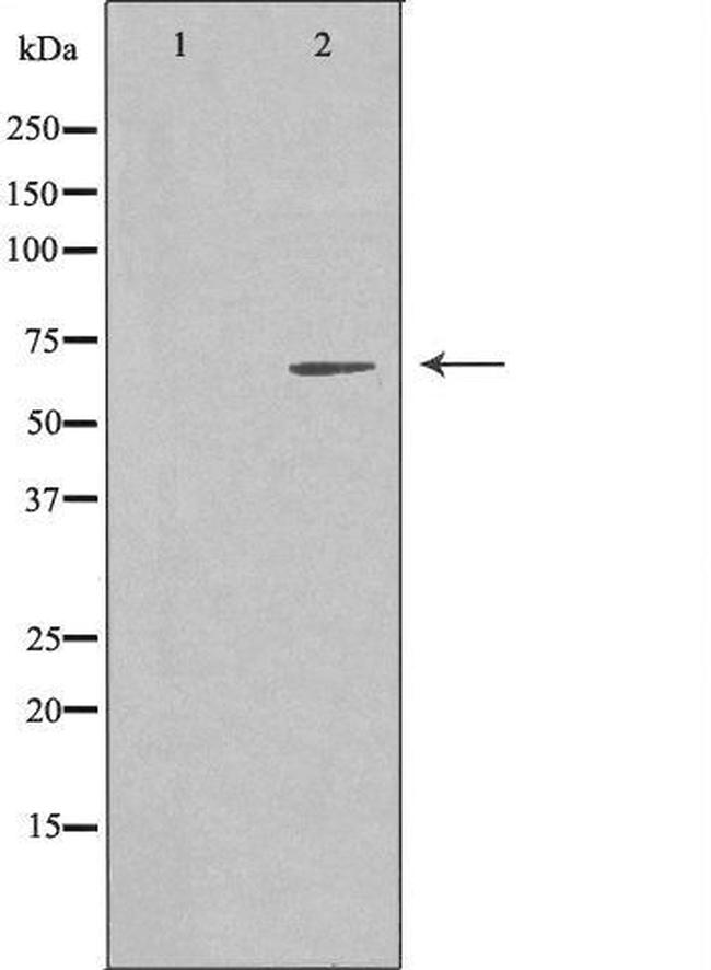EME1 Antibody in Western Blot (WB)