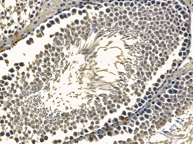 MNT Antibody in Immunohistochemistry (Paraffin) (IHC (P))