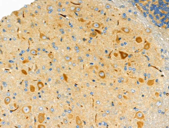 BRE Antibody in Immunohistochemistry (Paraffin) (IHC (P))