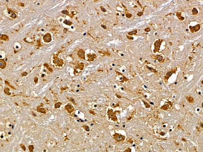 SLC30A9 Antibody in Immunohistochemistry (Paraffin) (IHC (P))