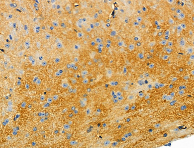 Cytochrome C1 Antibody in Immunohistochemistry (Paraffin) (IHC (P))