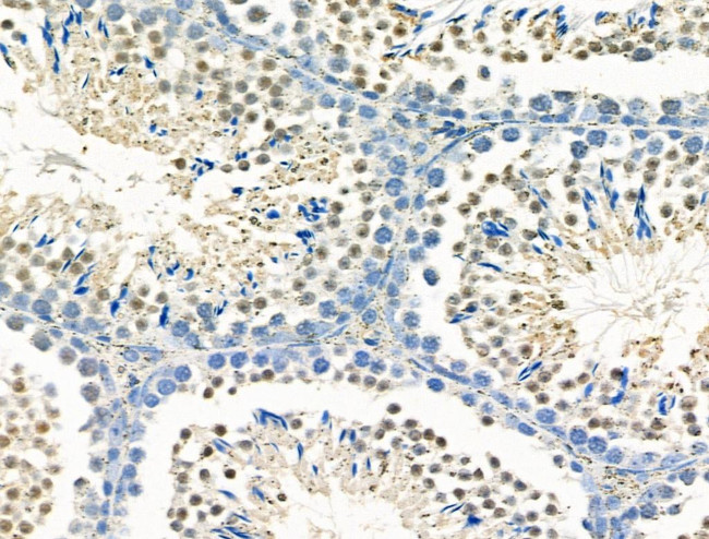 MX2 Antibody in Immunohistochemistry (Paraffin) (IHC (P))
