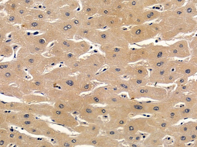 SNIP Antibody in Immunohistochemistry (Paraffin) (IHC (P))