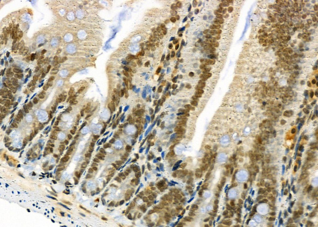 TAIP2 Antibody in Immunohistochemistry (Paraffin) (IHC (P))