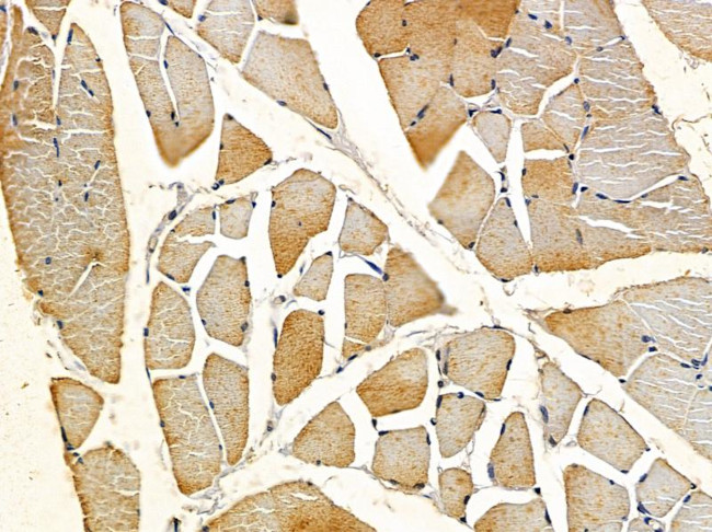 MYL7 Antibody in Immunohistochemistry (Paraffin) (IHC (P))