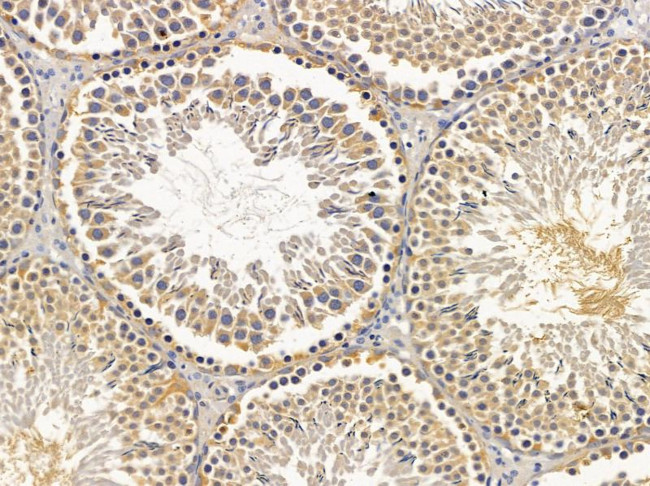 APC5 Antibody in Immunohistochemistry (Paraffin) (IHC (P))