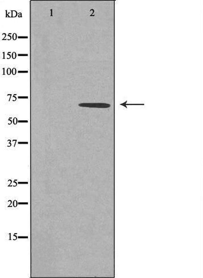 CAMKK2 Antibody in Western Blot (WB)
