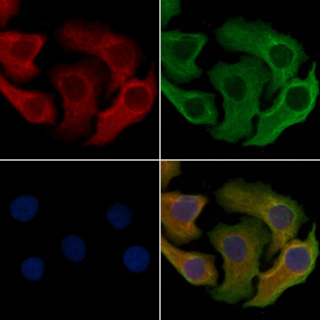 CCRD6 Antibody in Immunocytochemistry (ICC/IF)