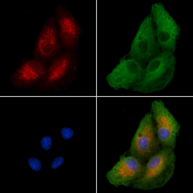 EDG6 Antibody in Immunocytochemistry (ICC/IF)